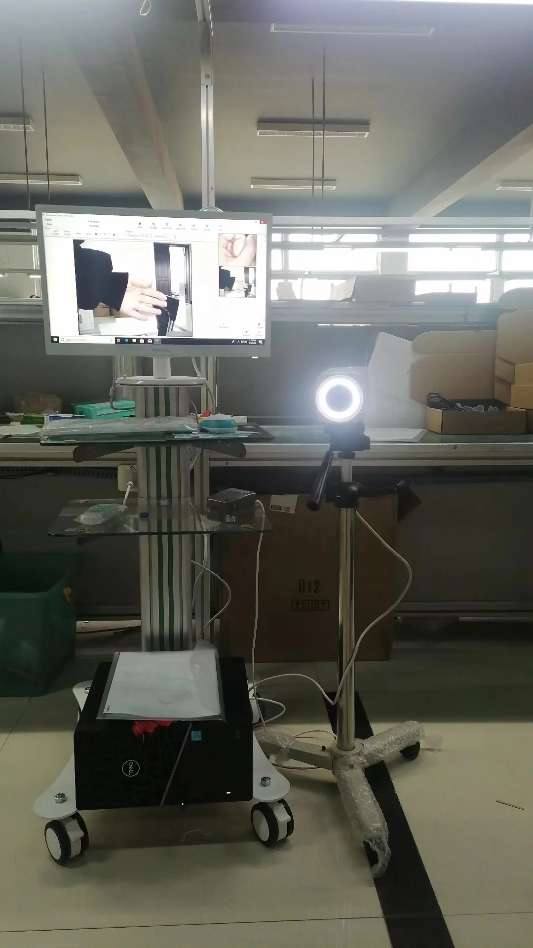 Medical specialized gynecological digital optical colposcopy with camera high-definition display