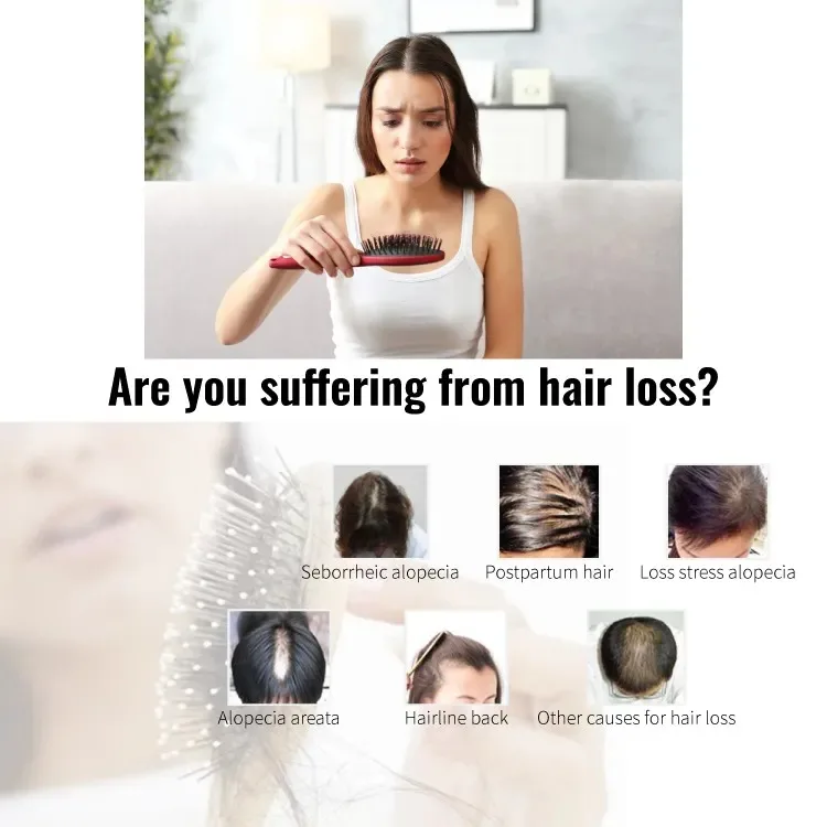 Organic Anti Hair Loss Rosemary Mint Herbal Extracts And Essences Hair Growth Shampoo And Conditioner Set