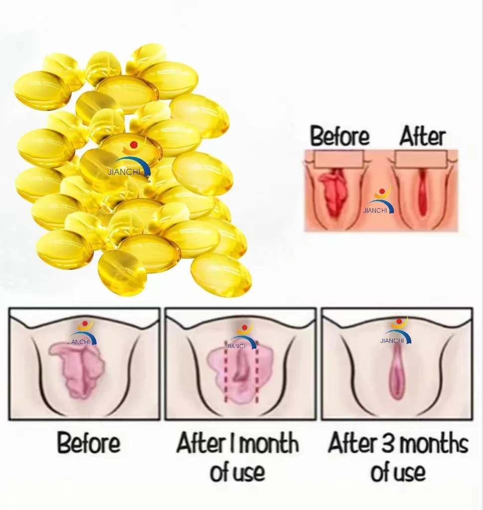 Virgin Blood Again Hymen Capsule Artificial Hymen Capsule First Night Women Blood Capsule Yoni Pills