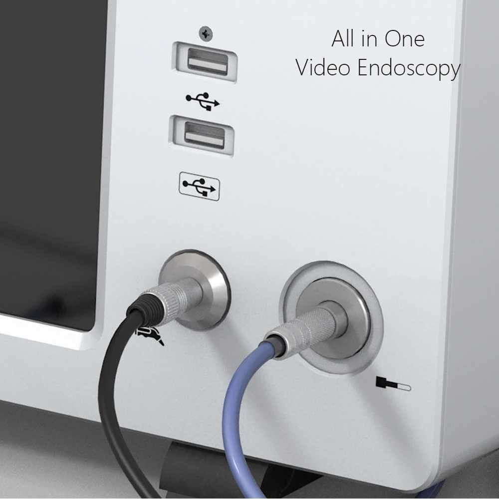 Integrated portable endoscopy camera unit 1080P for ENT