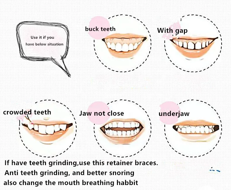 High quality custom logo box packaged dental dentsappareils tighten teeth aligner correction 3 stages teeth braces