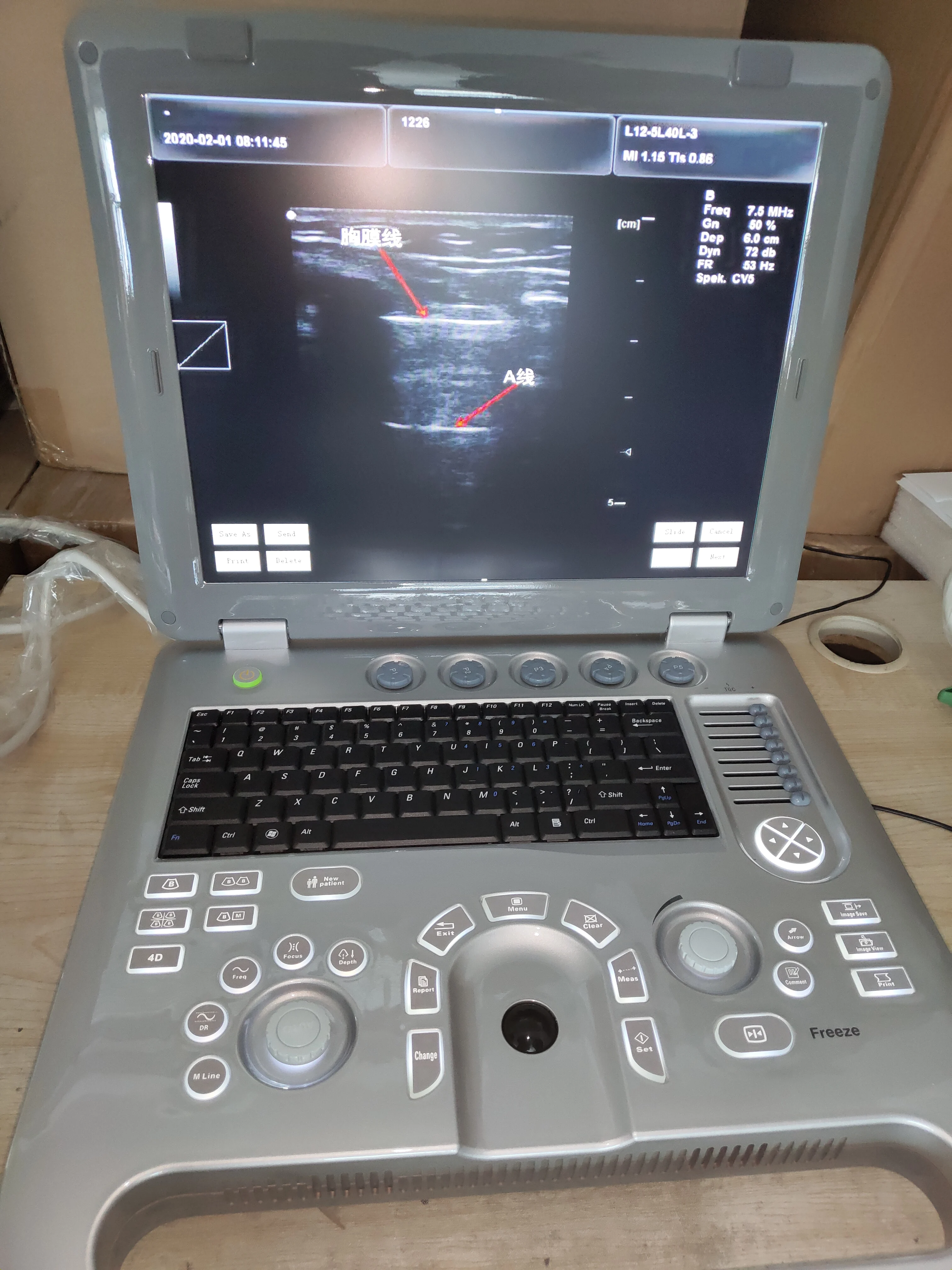 Laptop Diagnostic portable ultrasound veterinary sonar For Pregnancy