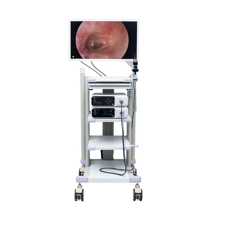 Endoscopy camera hospital equipment for laparoscopy hysteroscopy cystoscopy