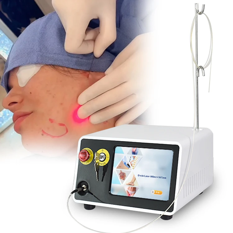 980 1470nm diode laser lipolysis machine liposuction canula endolaser machine fiber optic price