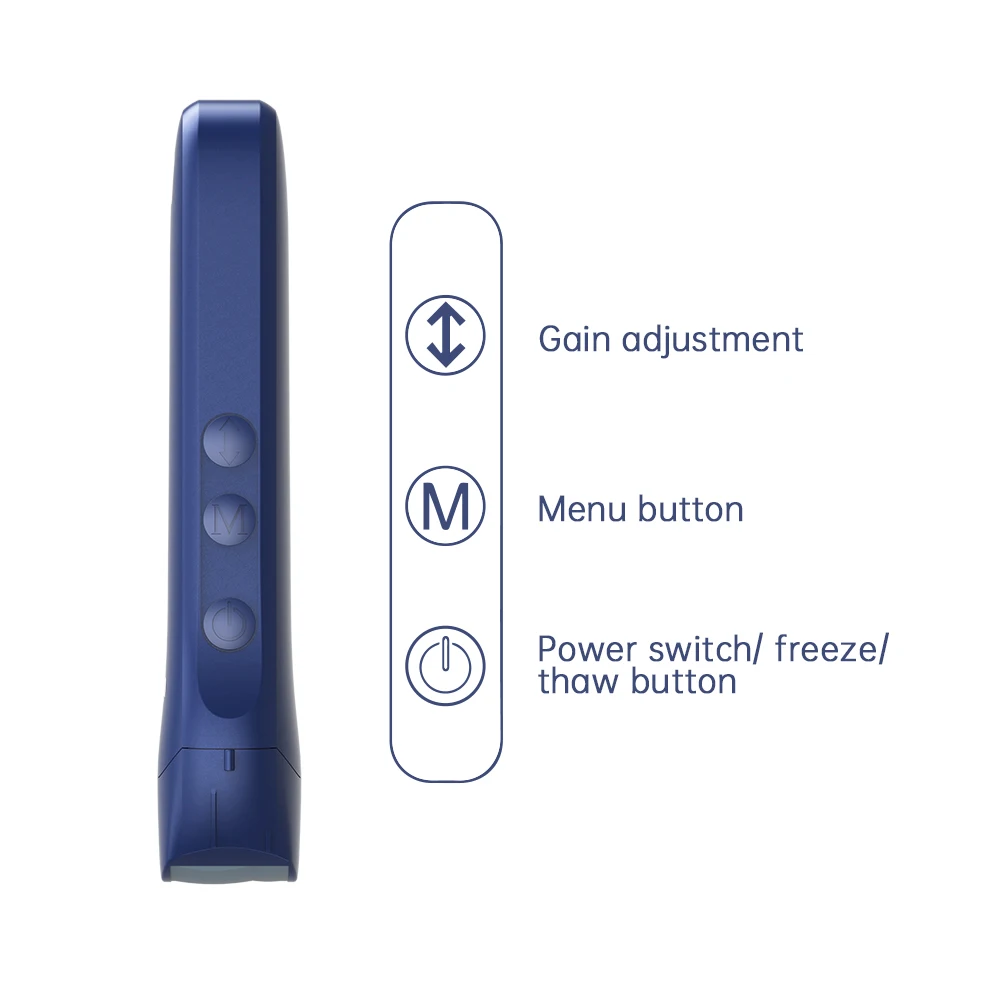 Viatom Handheld Ultrasound Probe 5 Display Mode One-Probe Multipurpose Wireless Portable Ultrasound Scanner