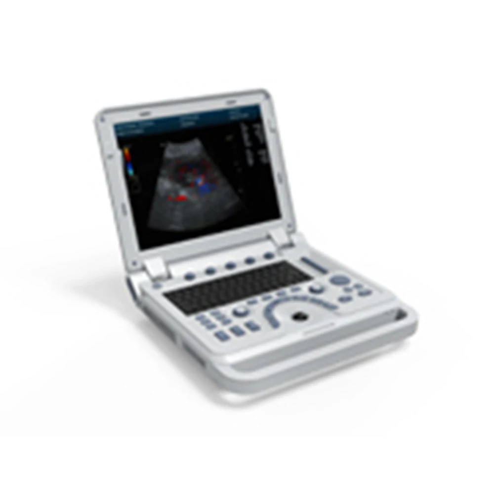 Contec CMS600P2PLUS portable ultrasound machine pseudo Color Doppler Ultrasonic Diagnostic System