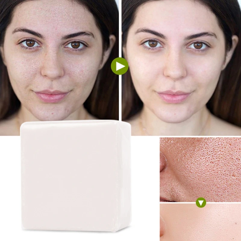 Natural Acne Handmade Soap With Collagen,Vitamin C And Rice Milk Foam Plant Soap With Amino Acid Bath Skin Whitening Soaps