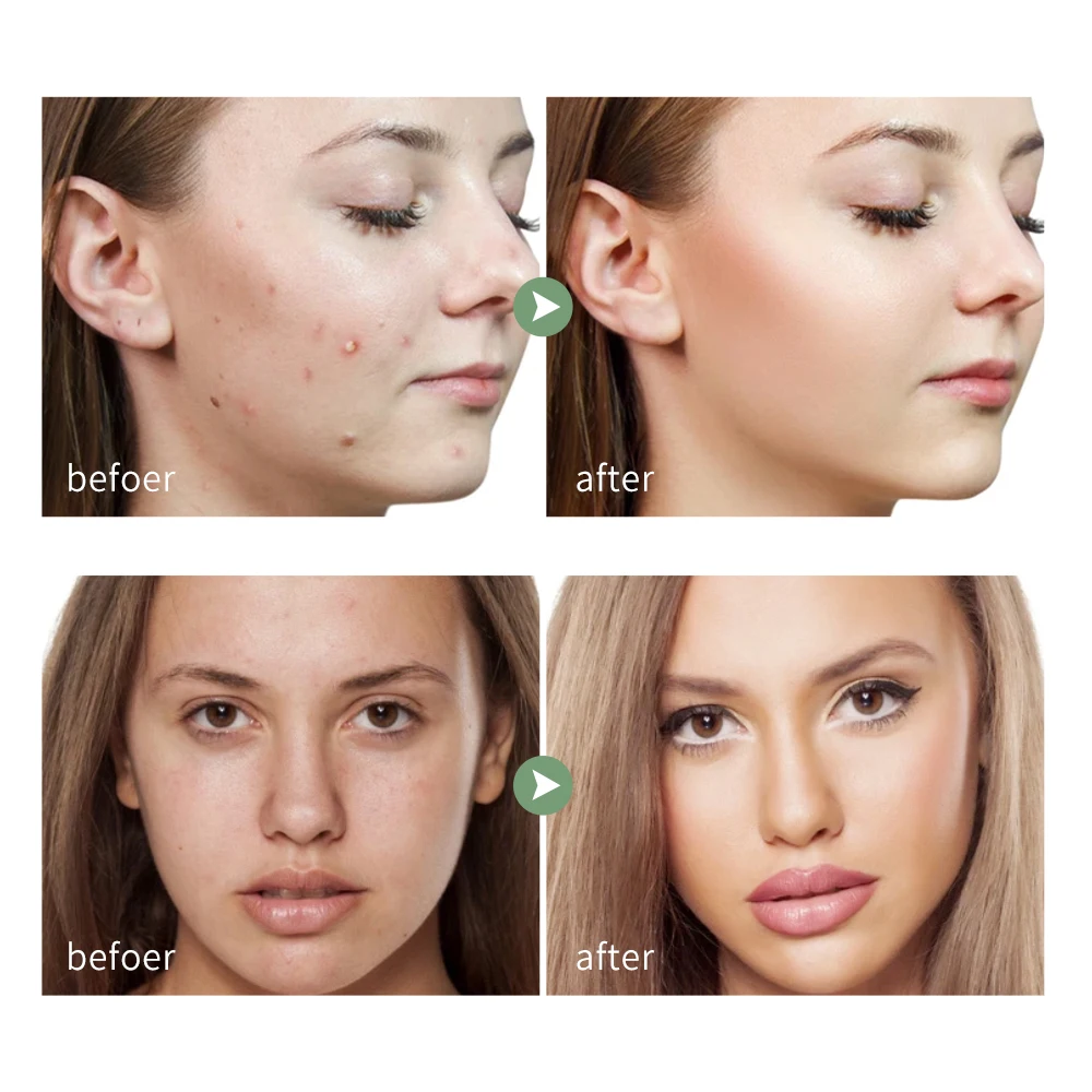 Гель с алоэ вера 100% натуральное увлажнение органический