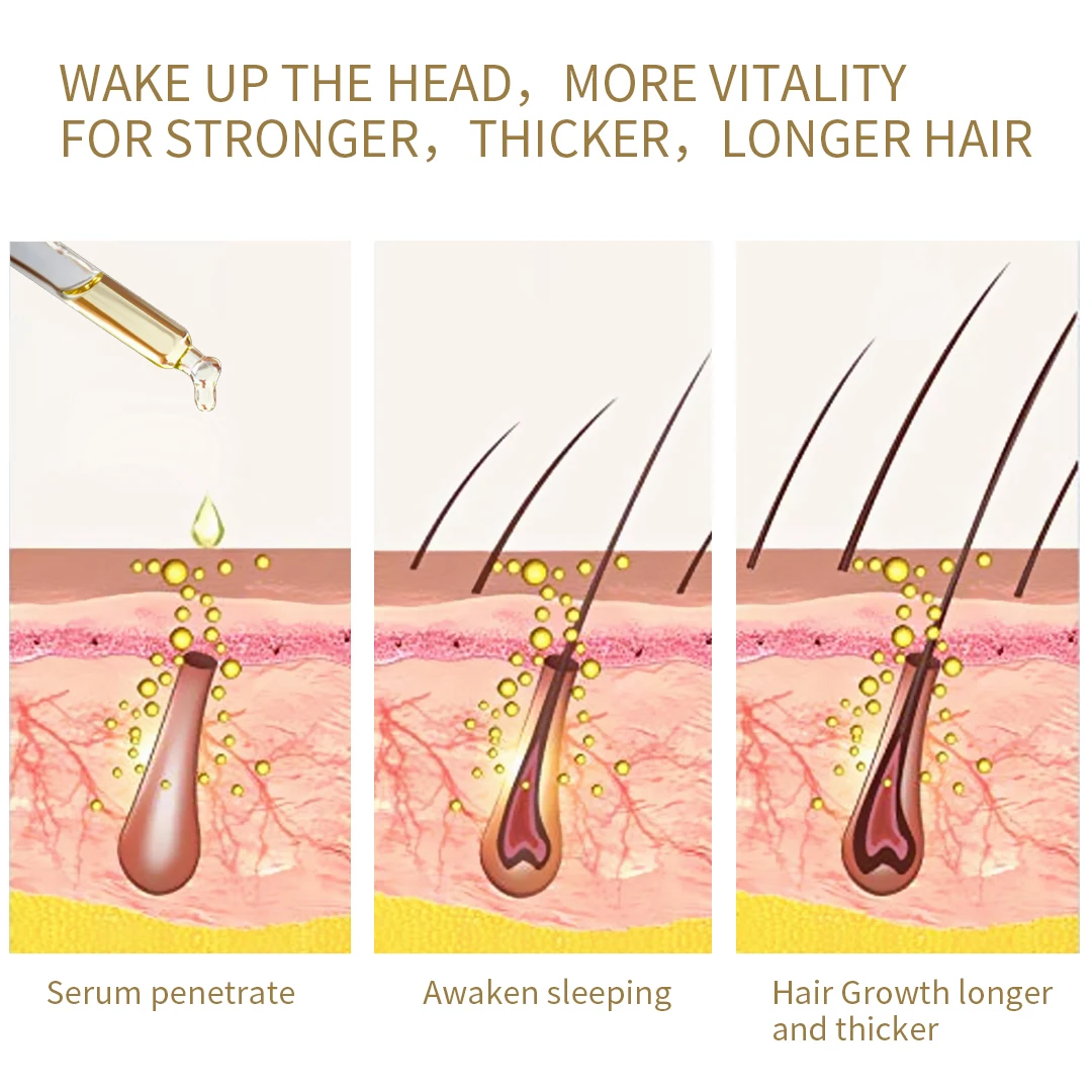 Private Label Natural Organic Vegan Treatment For Bald Hair Serum Wholesale Herbal Anti Hair Loss Boosting Hair Growth Oil