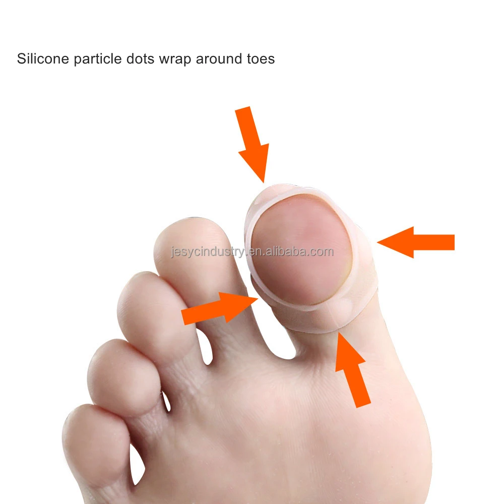 Foot Care Accessory Big Toe Nail Silicone Dot Corrector Ingrown Toenail Paronychia Treatment Tool Elastic Silicon Toenail Sleeve