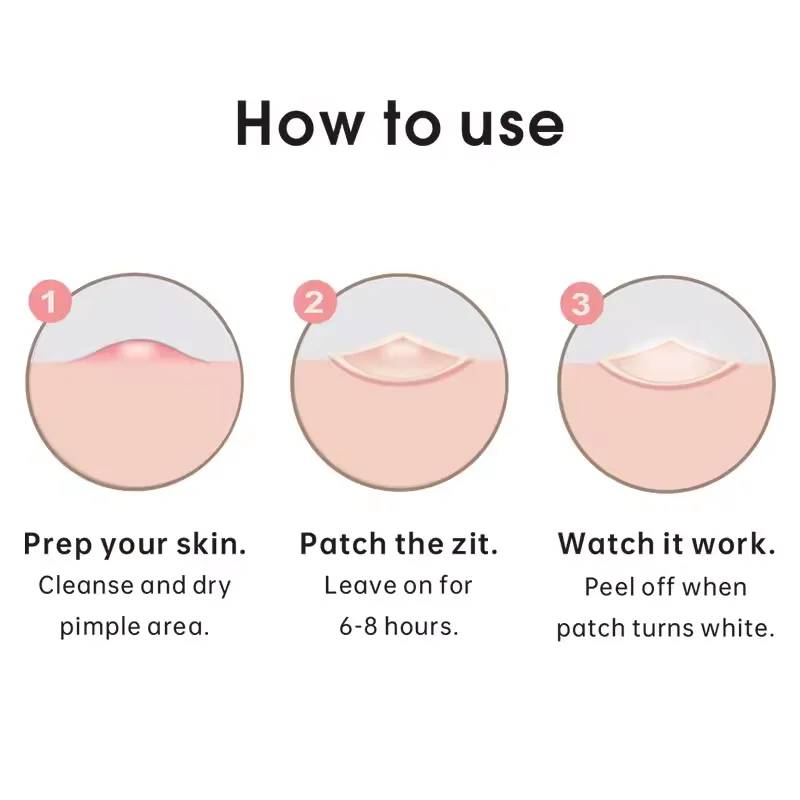 Oem Wholesale Private Label Miracle Acne Pimple Patch Spot Cover Facial Stickers Treatment Hydrocolloid Acne Pimple Patch