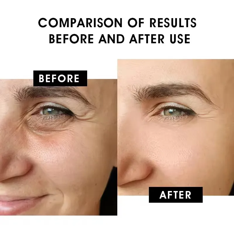 Antioxidant repair skin cell blue copper peptide serum anti-aging promote collagen regeneration copper peptide serum