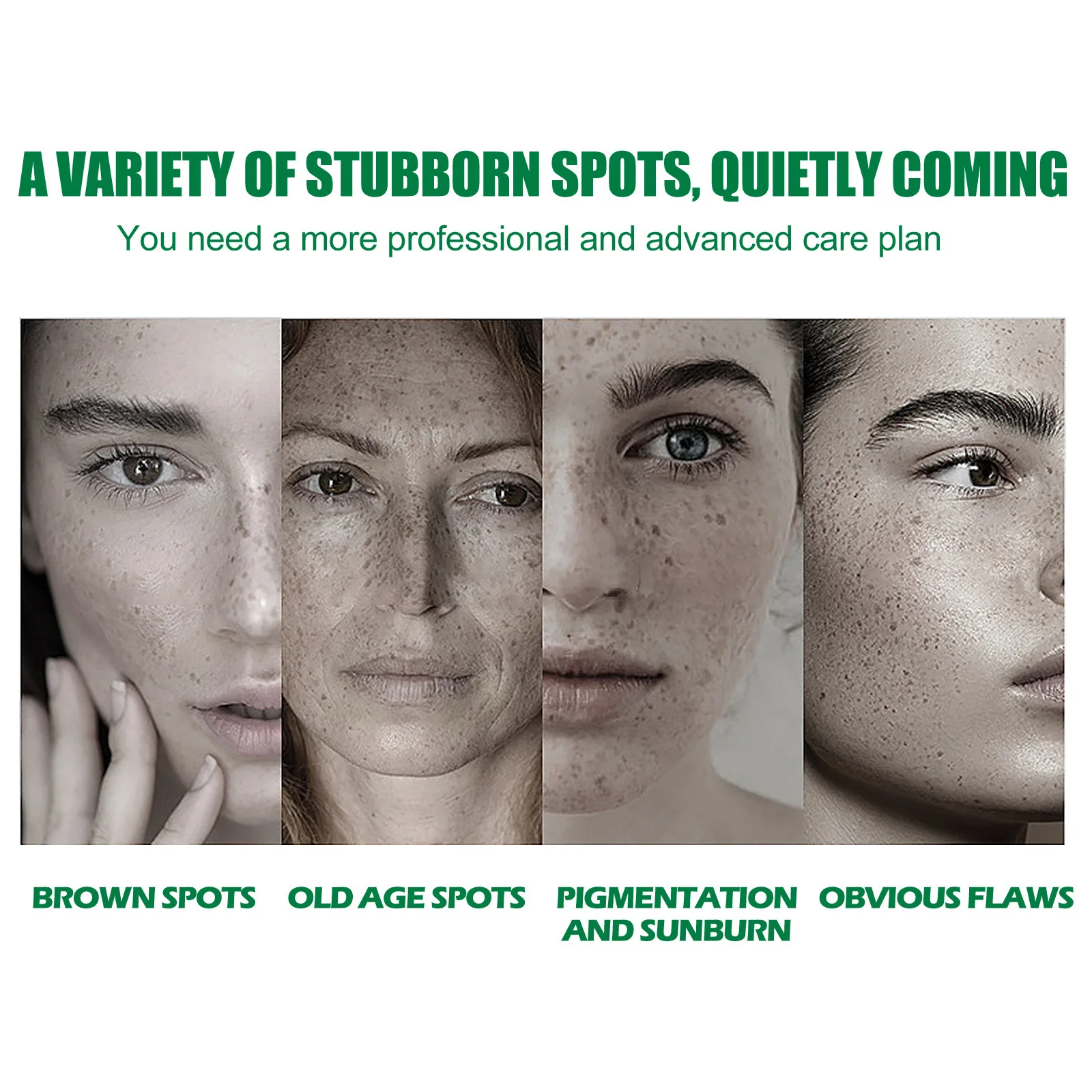 Spot Lightening Brightening Essence Repair Dullness Skin Care Beauty Skin Pigmentation Freckles Melanin
