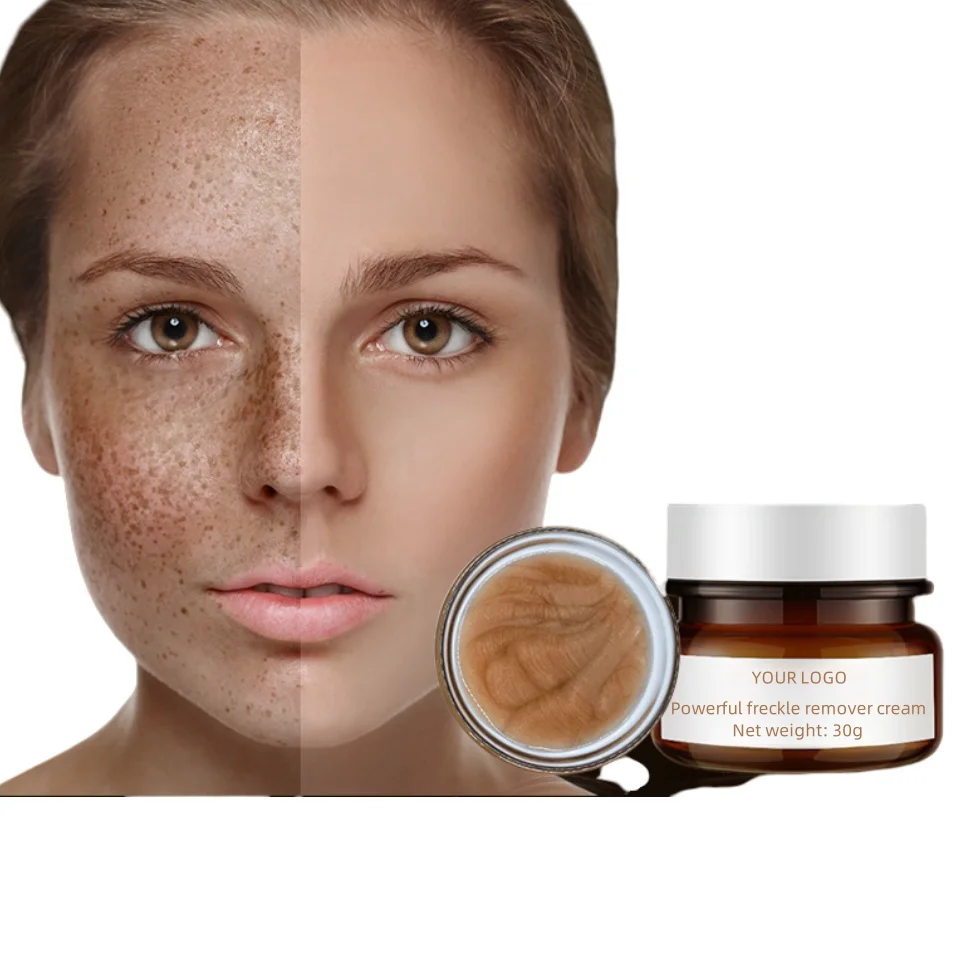 Hottest organic Strong Effective Skin Lightening Reduce Redness Burn Face Face Whitening Freckle Cream Remove Melasma Fade Dark