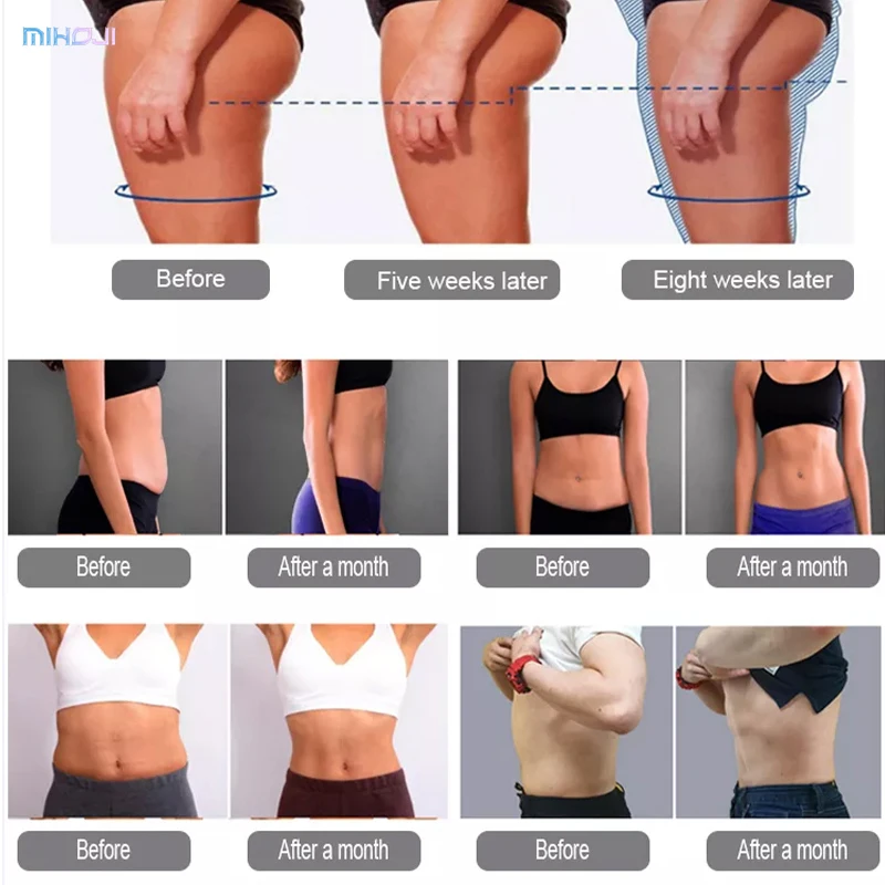 7 Tesla Ems Electrical Muscle Stimulation Body Sculpting Mini Emslim Machine Portable Emslim Neo With Rf