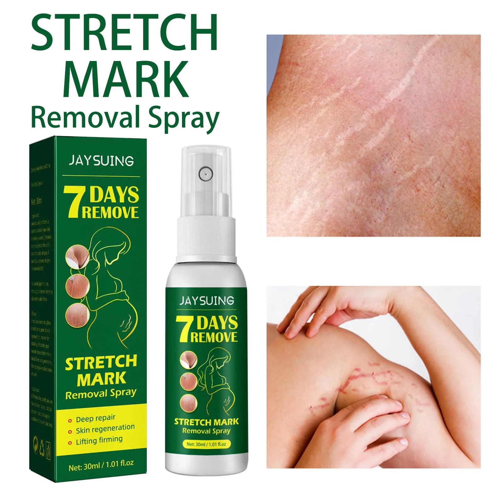 Hot Sale 100% Safe Natural Vegan Anti Postpartum Vergeture Marks Removal Repairing Scar Stretch Mark Spray