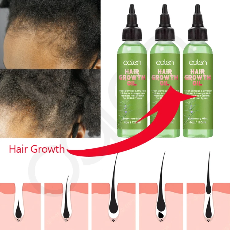 Oalen Hair Care Promote Hair Growth Massage Nourishing Saver Relieve Scalp Tension Refreshing Mint Scalp Oil