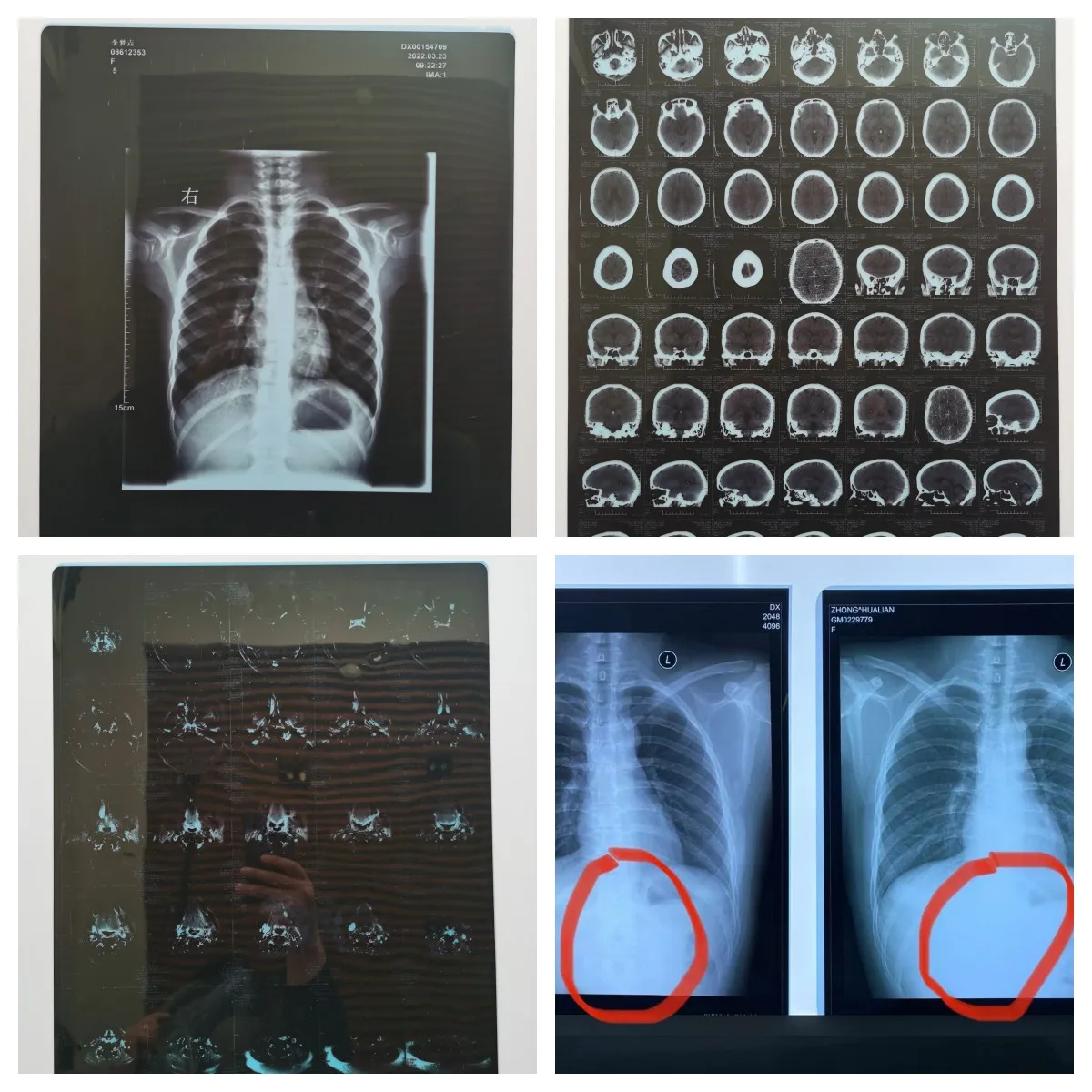 High Quality 14*17in FUJI DI-HL Dry imaging film  Medical X Ray Film Medical dry film