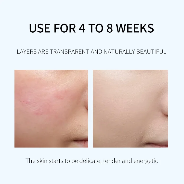 DSU OEM BIOAQUA private label Organic Skin Care Caviar Polypeptide whitening cream moisturizing skin care set