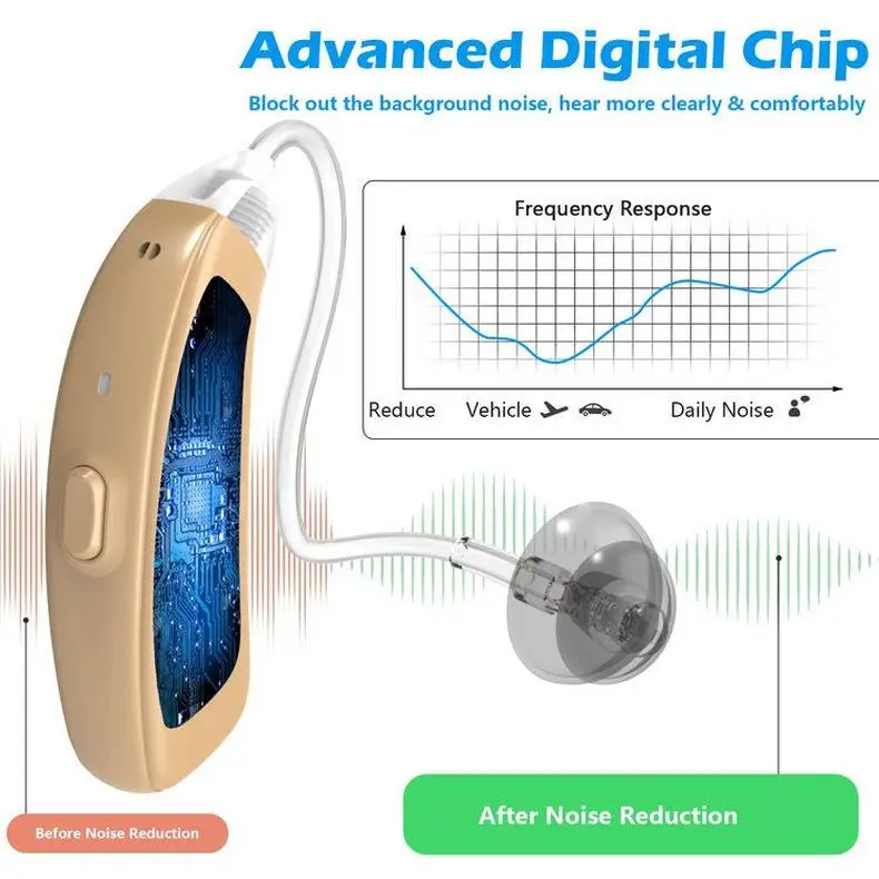 Competitive Price BlueDeer Digital Rechargeable Hearing Aids 16 Channels Noise Reduction Good Clear Sound Amplifier