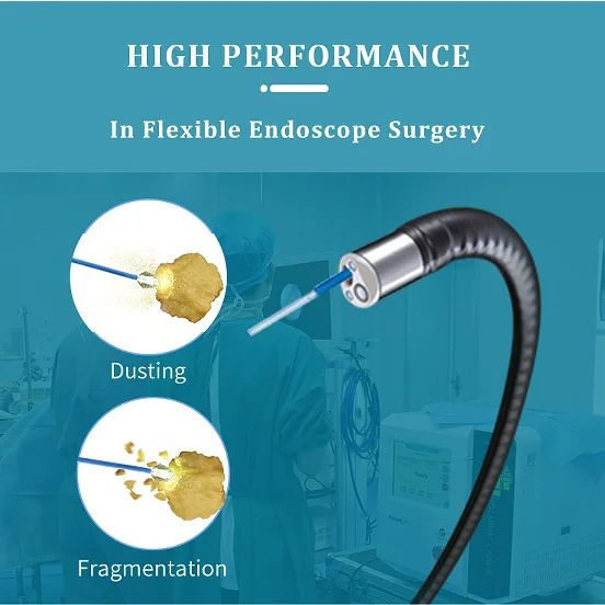 Портативный 40 Вт литотрипсия лазерный Laserlith i-dust хирургический уретрный YAG HO лазерный холмированный лазер полость для почечных камней