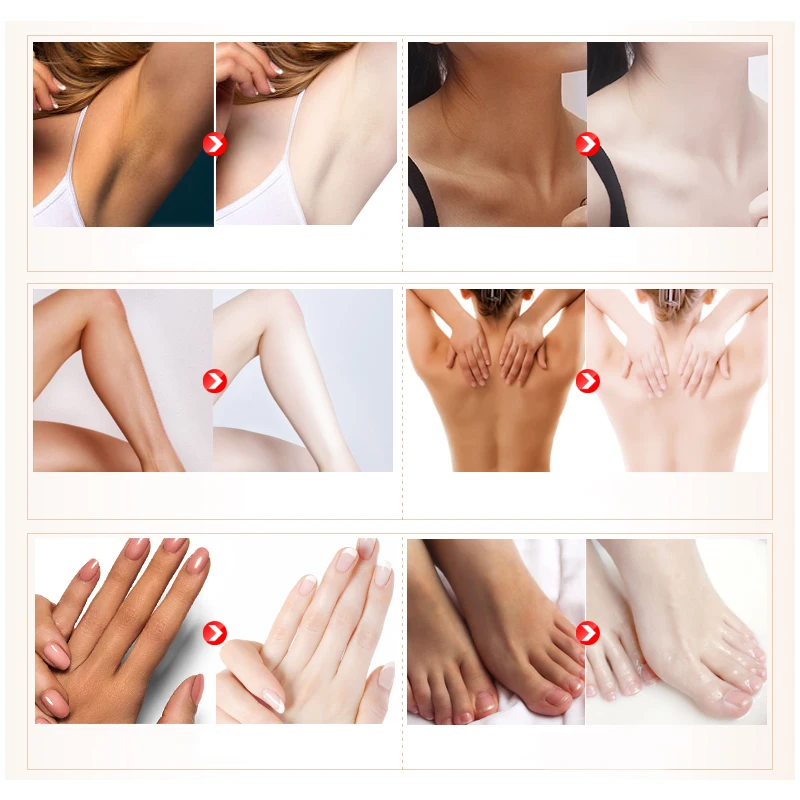 
Private label Instant whitening body lotion Black skin body bleaching rapidly OEM/ODM 