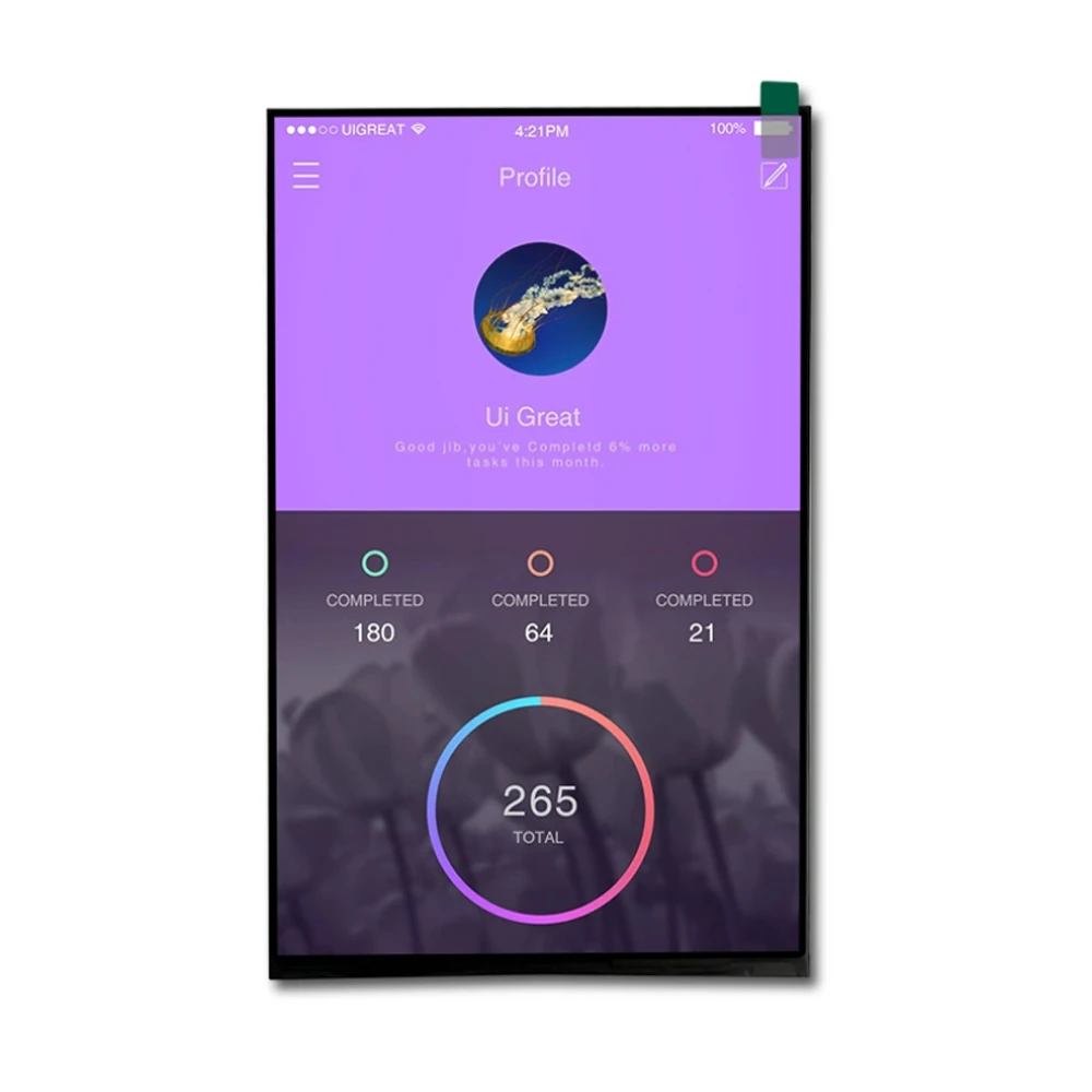 Customizable 10.1 Inch IPS 800*1280 LCD Display Module High Quality LCD Panel for Project Development