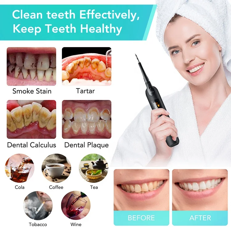LED Screen High Frequency Vibration Ultrasonic Tartar Remover Tooth Cleaner portable Dental water