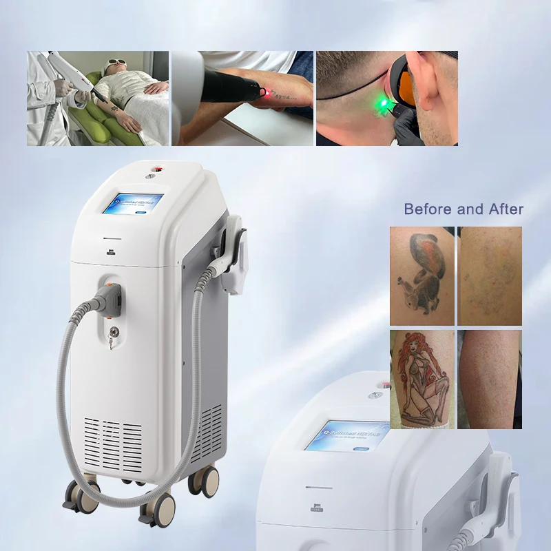 Apolo-laser q switch yag laser stationary Q switch Nd YAG laser tattoo removal equipment HS-250E+