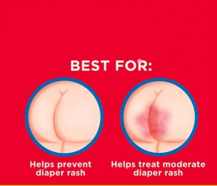 Oem odm уход за кожей ребенка частная марка бесплатные парабены детские подгузники крем набор для