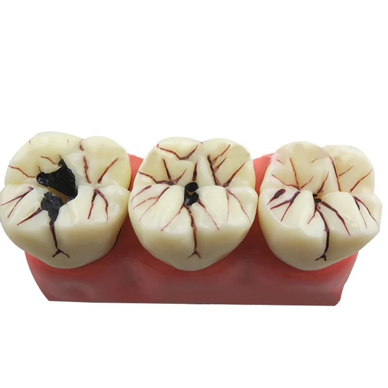 plastic teeth dental model dental study model teeth medical teeth model