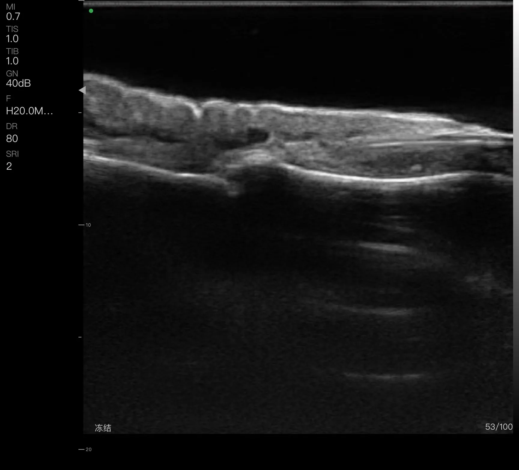 Periodmed Hot sale wireless handheld ultrasound machine wireless portable ultrasound