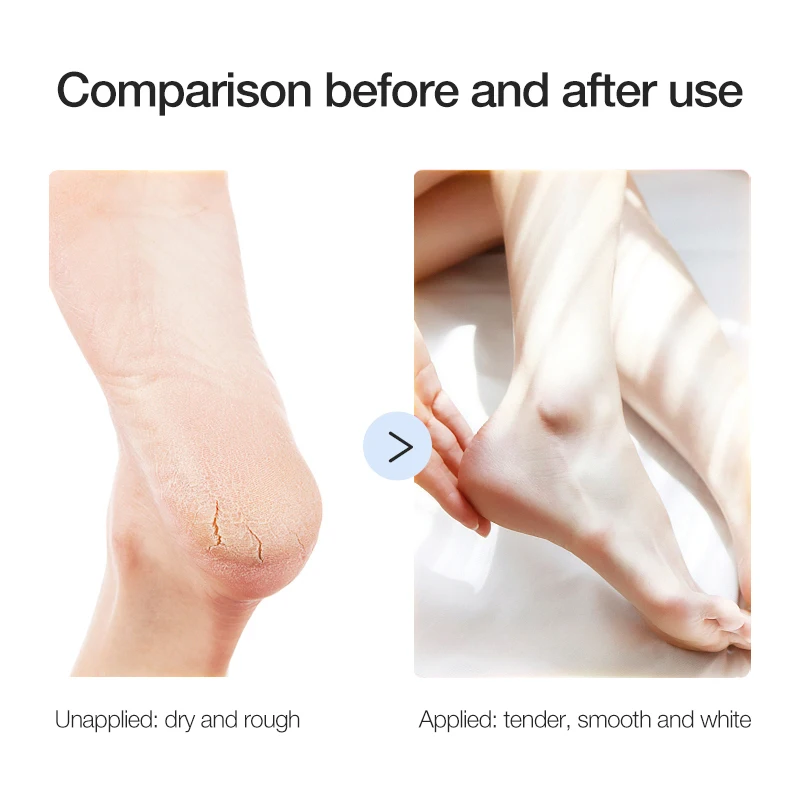 OEM Foot Skin Care Socks Peeling Feet Mask Peel Foot Masl Exfoliation Foot Mask Footmask Peelable Feet Mask Private