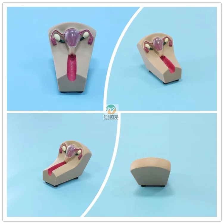 BIX-F5N medical science Female Intrauterine Contraceptive Training Model for Disease Demonstration Medical Teaching Tool