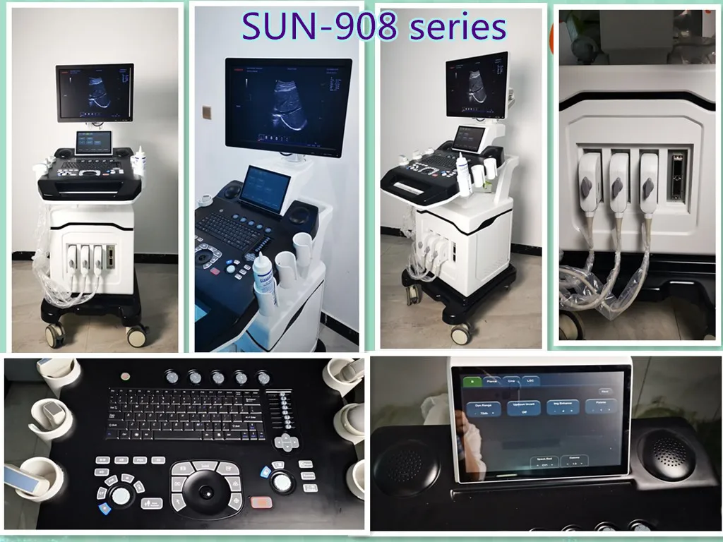 Newest trolley mobile colour doppler ultrasound machine 3D 4D Mobile cardiac echocardiogram