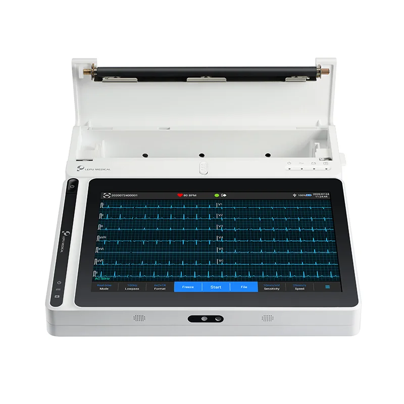 AI Analysis Electrocardiogram Smart ECG Monitor 12 lead Computer Multichannel ECG Machine