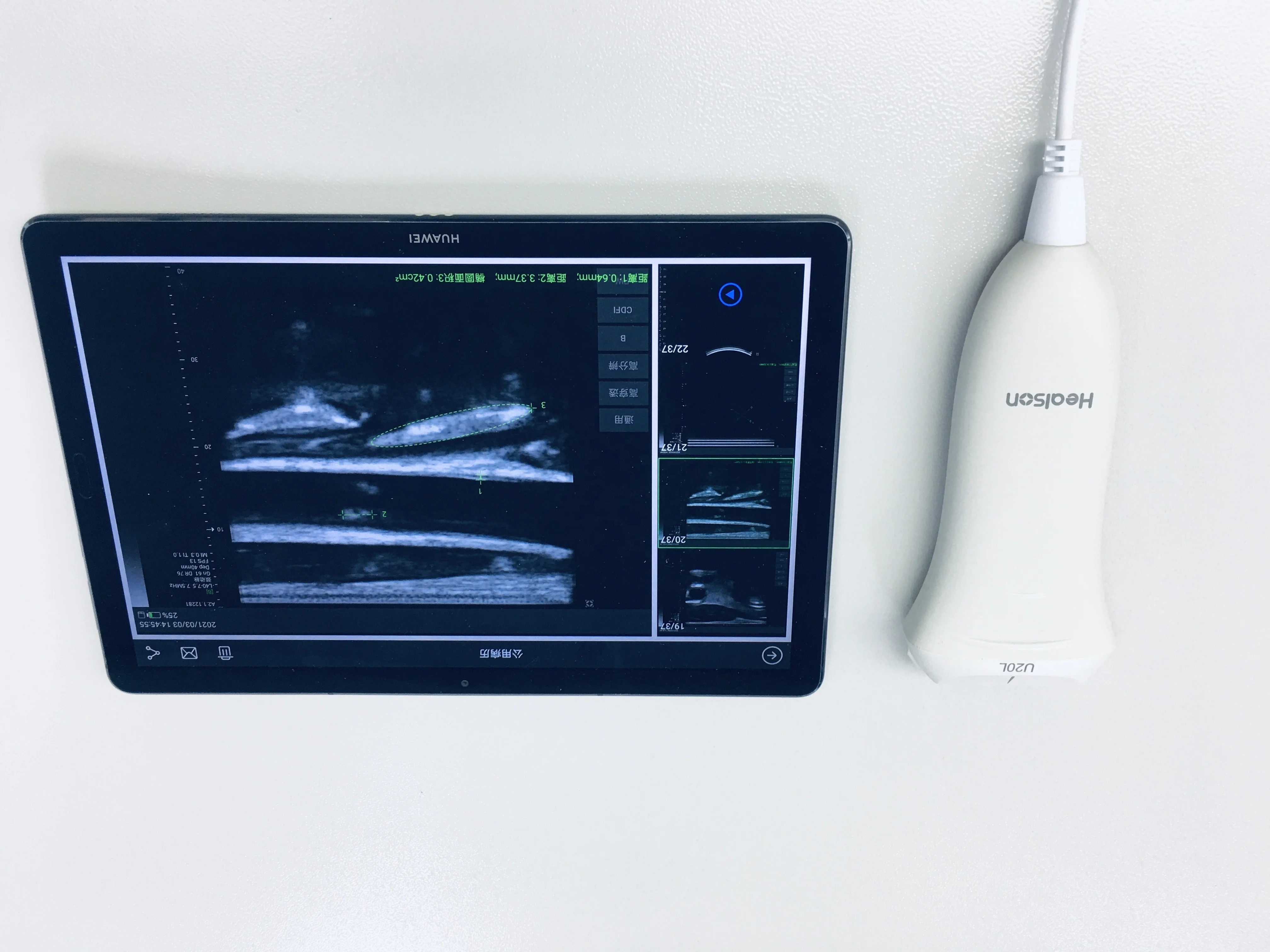 Healson U20L electric linear digital USB portable ultrasound machine