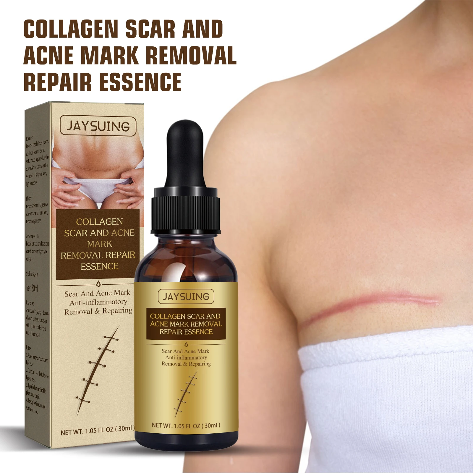 Hot Selling Natural organic fade Caesarean scar surgery scar to burn marks repair and smooth skin scar essential oil