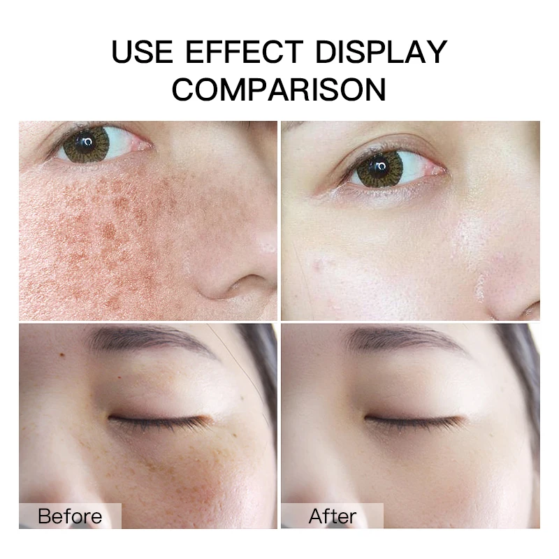 Biosphere Customized Niacinamide Cleansing Gel Cleansing Makeup Removal Paraben Free Hydrating Vegan Facial Cleanser