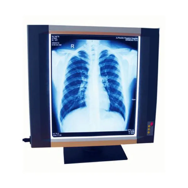 YSX1704 Spray-painted stainless steel LED x ray film viewer with single illuminator for sale