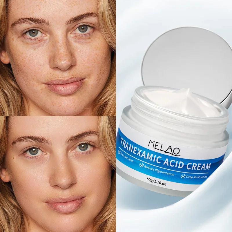 Крем-Транексамовая кислота с витамином