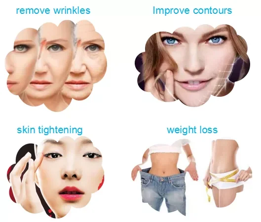 2022 new cavity radio frequency liposuction slimming machine