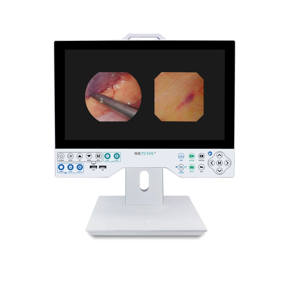 FHD 15 Inch Rigid and Flexible All In One Endoscope Camera