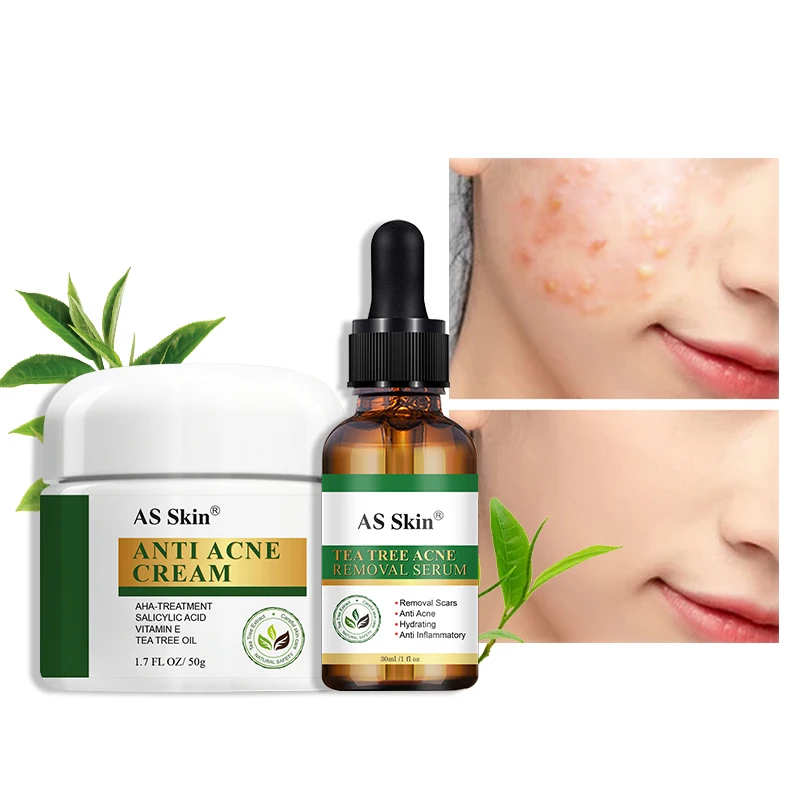 Private Label Natural Herbal Face Care Anti-Acne Treatment Kit Tea Tree Oil Acne Removal Facial Skin Care Set