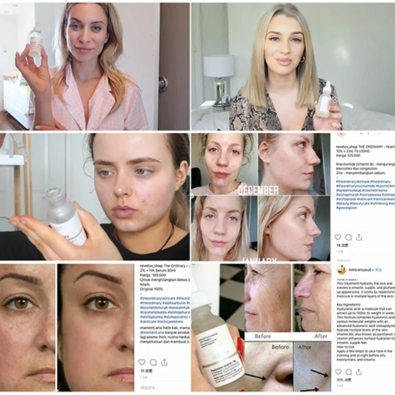 Niacinamide 10% Zinc 1% Quality 30ml High Mineral and Wholesale Skin Care Face Serum Liquid Collagen Female OEM/ODM