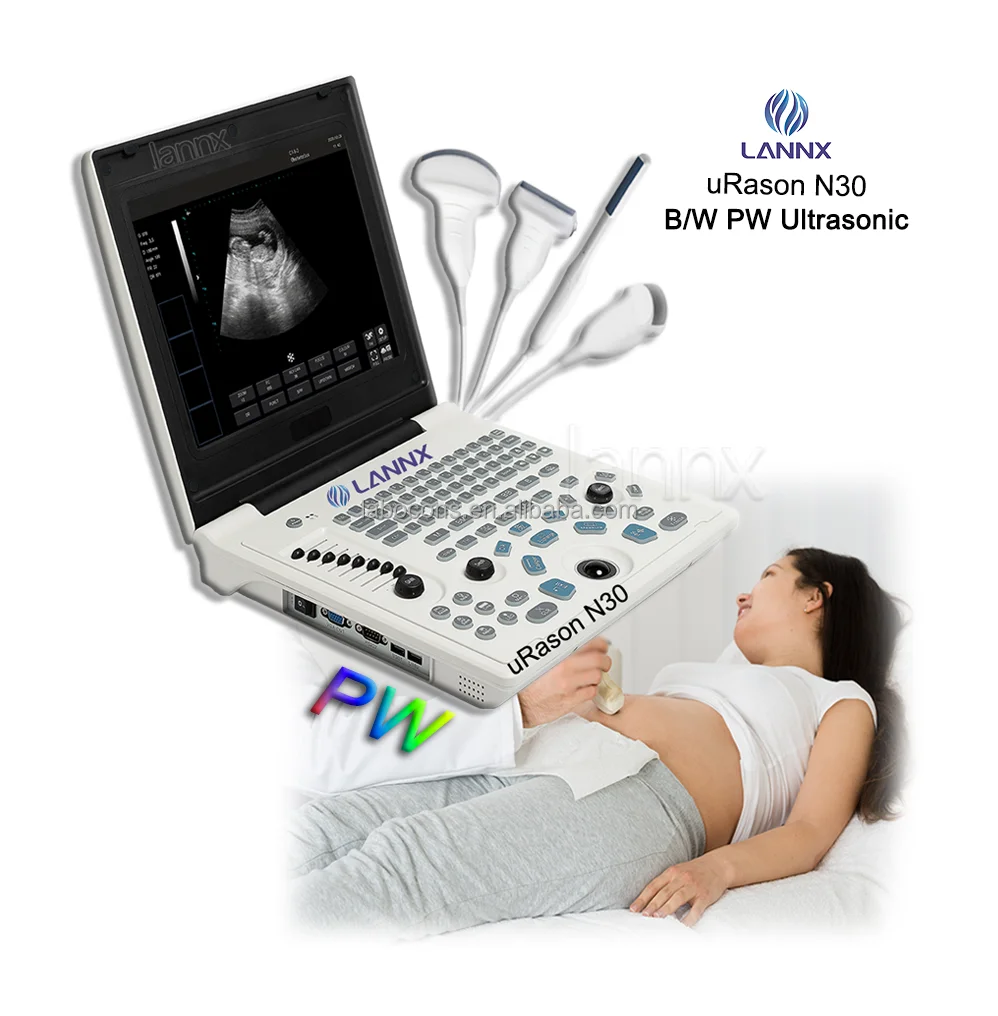 LANNX uRason N30 Cheapest Portable Color PW Ultrasound Echo Machine Diagnostic Ultrasound System for Clinic B/W Laptop USG