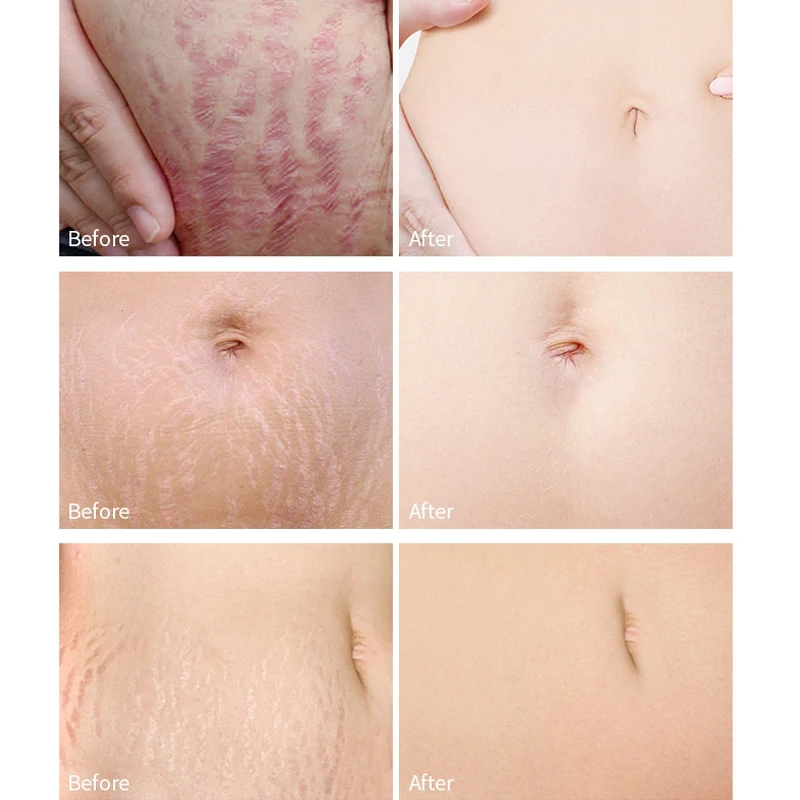 LANTHOME private label hydrating anti-aging skin care Hyaluronic acid vitamin e  face serum