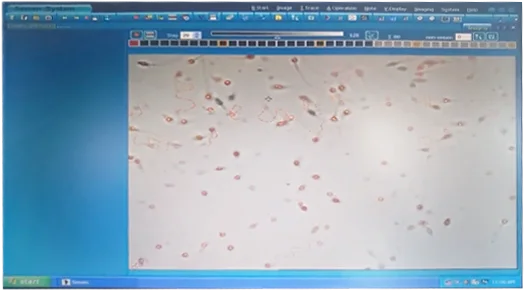 AEALB Sperm Quality Analyzer Automatic Human Sperm Analyzer Instrument