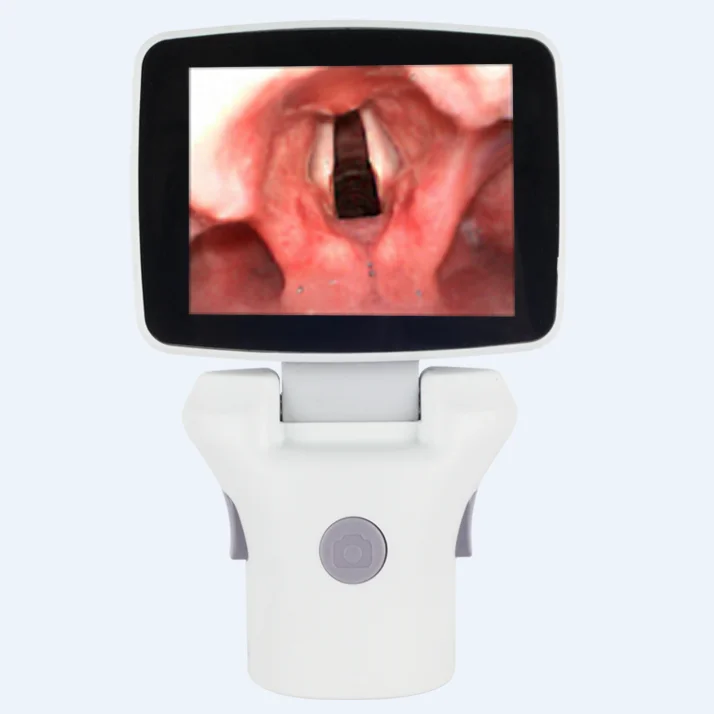 Surgical Instruments Endoscopic Video System Optical Video Laryngoscope