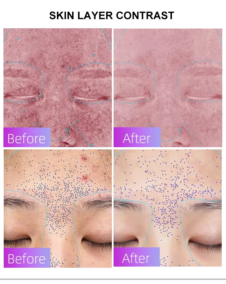 7 colors liquid silicone smart led red light therapy device for home use